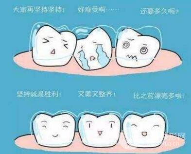 网络辟谣！口腔名医破解牙齿矫正4大谣言(图1)