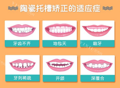 牙齿矫正需要多少费用？分享2024年常见正畸方式收费价目表！(图2)